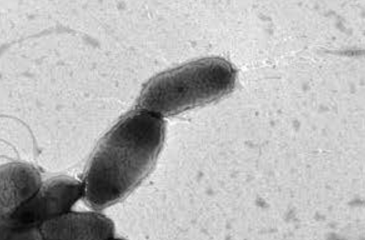 Phthalate-degrading microorganism
